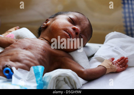 Neonato premature baby boy nella maternità area dell'Ospedale Sacra Famiglia di Techiman il, Ghana Foto Stock