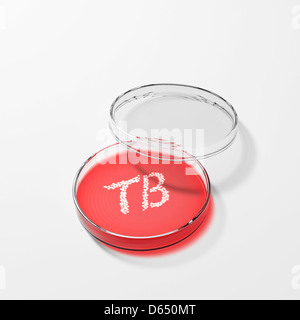 I batteri responsabili della tubercolosi in una capsula di petri Foto Stock