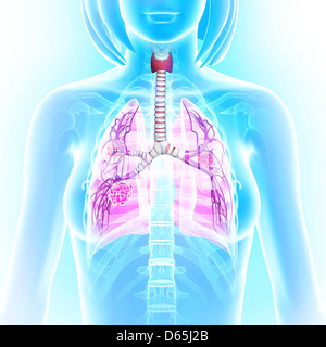 Polmoni femmina, artwork Foto Stock