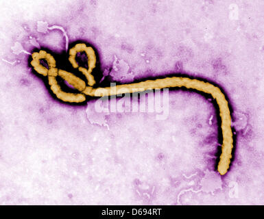 Dispensa - creato da CDC microbiologo Frederick A. Murphy, questo colorizzato micrografia elettronica a trasmissione (TEM) ha rivelato alcuni della morfologia ultrastrutturale visualizzate da un virus Ebola virione datata (immagine). Foto: Federico Murphy/CDC (obbligatorio credito; zu dpa: 'Bisher 14 Tote bei neuem Ebola-Ausbruch in Uganda') +++(c) dpa - Bildfunk+++ Foto Stock
