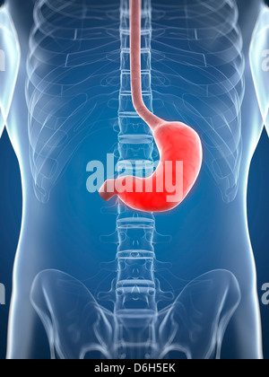 Stomaco infiammato, opere d'arte concettuale Foto Stock