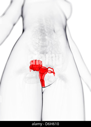 Cancro uterino, artwork Foto Stock