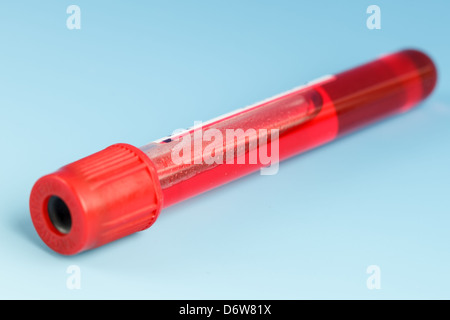 Campione di sangue in una provetta vacutainer Foto Stock