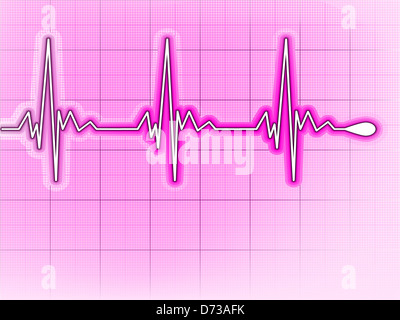 Illustrazione raffigurante un grafico da un battito cardiaco e un cuore Foto Stock