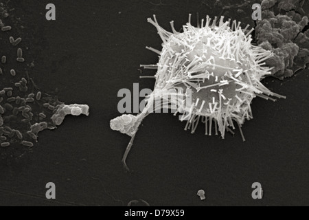 Scanning Electron microfotografia acqua non trattata campione