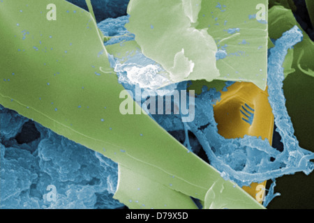 Scanning Electron microfotografia acqua non trattata campione