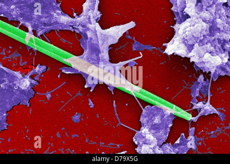 Scanning Electron microfotografia acqua non trattata campione
