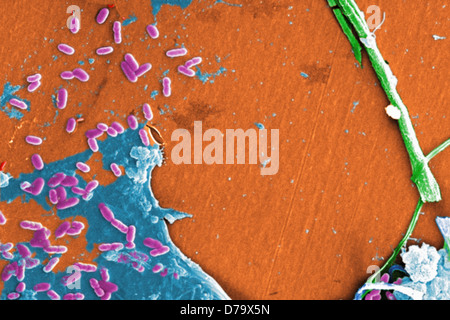 Scanning Electron microfotografia acqua non trattata campione