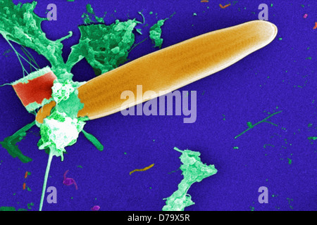 Scanning Electron microfotografia acqua non trattata campione