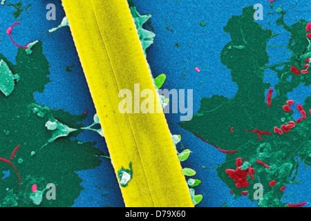 Scanning Electron microfotografia acqua non trattata campione
