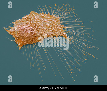 Cancro osseo cella, SEM Foto Stock