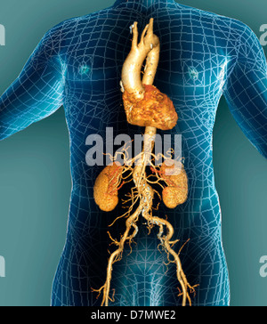 Aorta, 3D CT scan Foto Stock