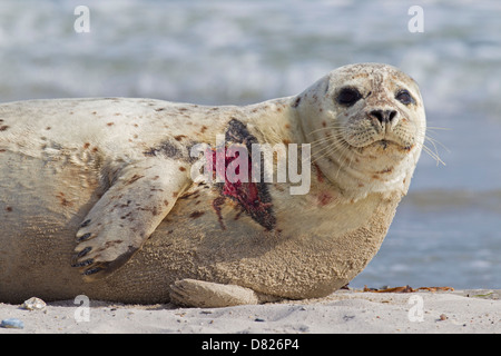 Feriti guarnizione comune / Harbour guarnizione (Phoca vitulina) con la ferita della carne in appoggio sulla spiaggia Foto Stock