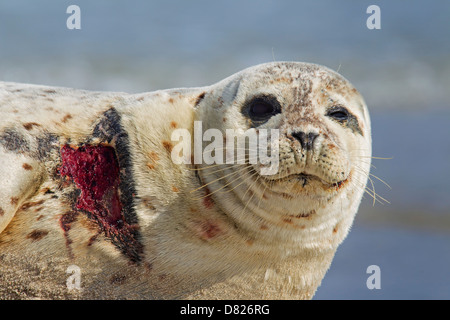 Feriti guarnizione comune / Harbour guarnizione (Phoca vitulina) con la ferita della carne in appoggio sulla spiaggia Foto Stock