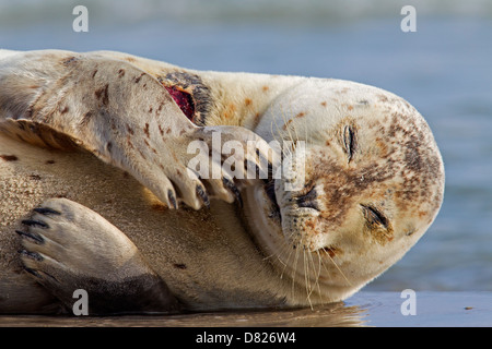 Feriti guarnizione comune / Harbour guarnizione (Phoca vitulina) con la ferita della carne in appoggio sulla spiaggia Foto Stock