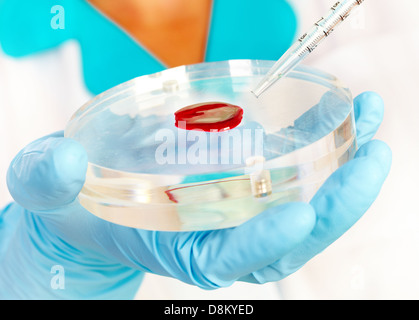 Mano doc contiene il test per il sangue Foto Stock