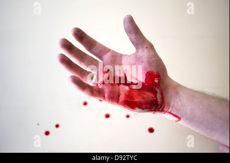 La mano di un uomo coperto di sangue Foto Stock