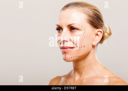 Donna di mezza età tenetevi pronti per un intervento di chirurgia plastica Foto Stock