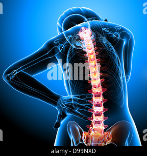 Essere umano dolore alla schiena anatomia Foto Stock