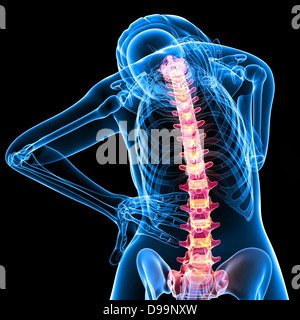 Essere umano dolore alla schiena anatomia Foto Stock