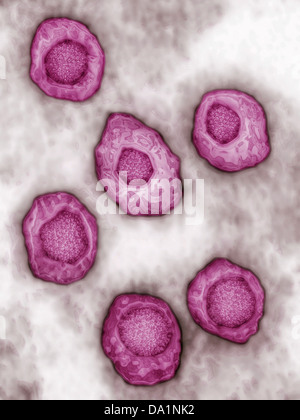 Il virus di Epstein Barr Foto Stock