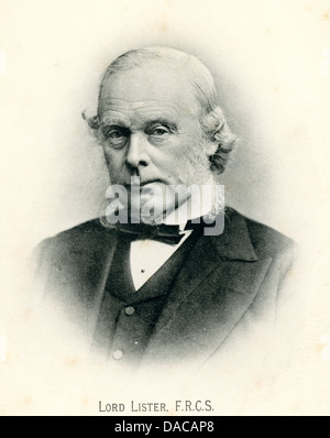 Joseph Lister, primo Baron Lister, 1827 1912, fu un chirurgo britannico e un pioniere della chirurgia antisettica Foto Stock