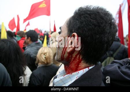 Un sanguinamento manifestanti guarda per i paramedici dopo gli scontri tra la polizia e manifestanti in una marcia di protesta contro il prossimo vertice del G8 a Rostock (Germania), 2 giugno 2007. Il vertice si svolgerà sotto immenso le misure di sicurezza in Heiligendamm sulla costa del Mar Baltico dal 6 al 8 giugno 2007. Foto: Kay Nietfeld Foto Stock