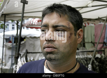 Gurminder Singh, uno degli otto vicitims di chivy sui visitatori indiano di una città di festa, pongono a un amico della cabina di un mercato settimanale in Doebeln, Germania, 22 agosto 2007. Una cinquantina di giovani tedeschi inseguita e feriti otto Indiani dopo un argomento in Muegeln domenica notte (19 agosto). Foto: Waltraud Grubitzsch Foto Stock