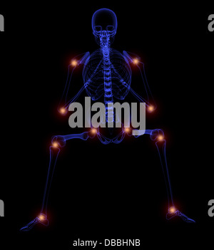3d'illustrazione - giunti doloroso Foto Stock