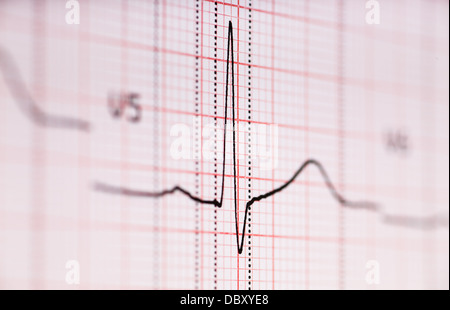 Grafico di ECG Foto Stock