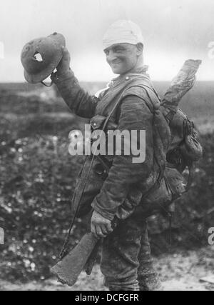 Grande Guerra. WW1 un soldato britannico con la testa fasciata sulla strada verso la parte posteriore e in ospedale mostra la sua shrapnel danneggiato acciaio casco Foto Stock