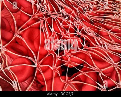 Immagine concettuale di cellule rosse del sangue con fibrina. Foto Stock