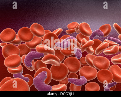 Immagine concettuale di anemia falciforme con le cellule rosse del sangue. Foto Stock