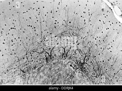Medicina, anatomia, cerebrico / cranio, cortici del cervelletto umano, foto di Dr. Adelheid Winkelmann, 20 ° secolo, 20 ° secolo, microscopia, cellula nervosa, cellule nervose, neurale, neuritico, percorso nervoso, tratto nervoso, vie nervose, tratti nervosi, corteccia cerebrale, cervelletto, medicina, farmaci, storico, storico, diritti aggiuntivi-clearance-non disponibili Foto Stock