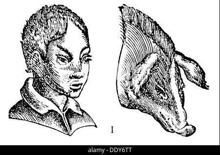 Medicina, anatomia, fisiognomia, analogia di maiale e umano, dopo Giambattista della porta (1535 - 1615), 'De Humana Physiognomia', 1586, incisione in legno, da: 'Grosser Brockhaus', circa 1900, diritti aggiuntivi-clearences-non disponibili Foto Stock