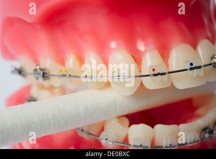 Igiene dentale, dentiere con apparecchio fisso di mordere su un batuffolo di cotone Foto Stock