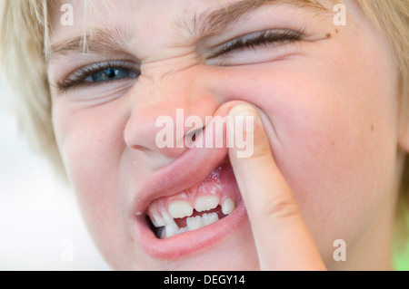 Un giovane bambino mostra i suoi denti Foto Stock