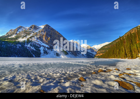 Lago ghiacciato di Louise nel sole di mattina nel Parco Nazionale di Banff, Alberta, Canada Foto Stock