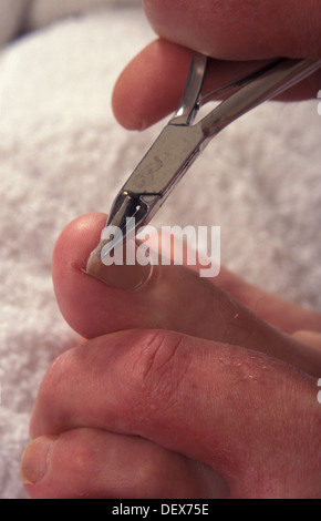 Close up uomo toenails di taglio con il tagliaunghie Foto Stock