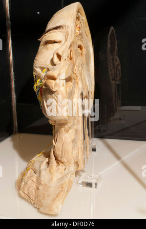 Plastination campione della sezione di una testa umana e del collo Foto Stock