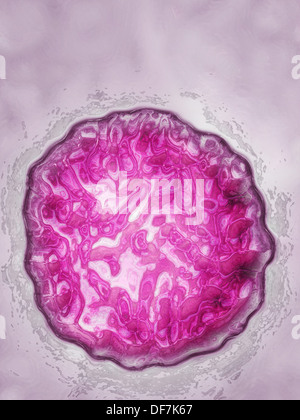 Il virus dell epatite C Foto Stock