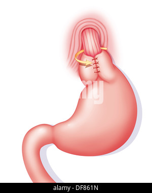 FUNDOPLICATION, disegno Foto Stock