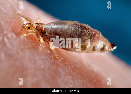 Pidocchio Del Corpo Foto Stock Alamy
