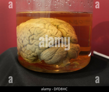 Cervello umano in un vaso, Cornell University. Il cervello è parte del Wilder Raccolta del cervello Foto Stock