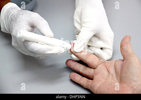 L'immagine i prelievi di sangue a portata di mano e di rilevare le anomalie. Foto Stock