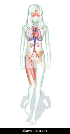 LUPUS eritematoso sistemico Foto Stock