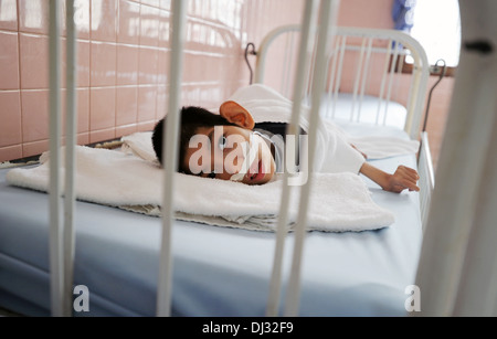 Un fisicamente e mentalmente disabili bambino giace in un letto di ospedale a Tudu Hosipital nella città di Ho Chi Minh, Vietnam. Foto Stock