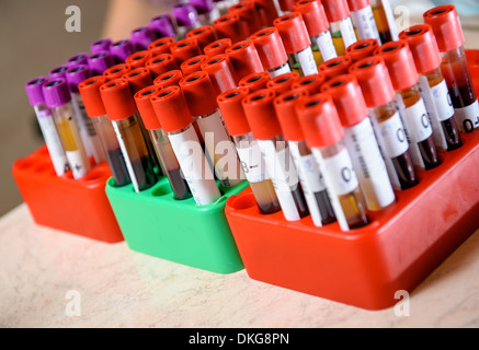 Medical provetta con i campioni di sangue Foto Stock
