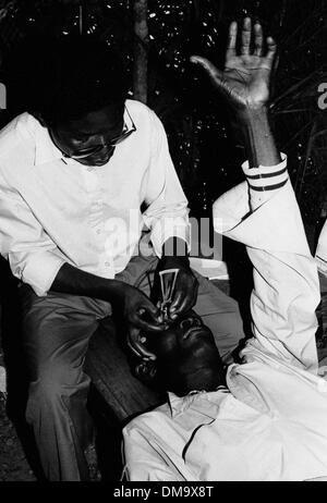 Mar 01, 1993 - Bo, Sierra Leone - Locale abitante ha gli occhi controllati dal medico da chairty vista risparmiatori in un villaggio vicino a Bo Sierra Leone. (Credito Immagine: © Theodore Liasi/ZUMAPRESS.com) Foto Stock