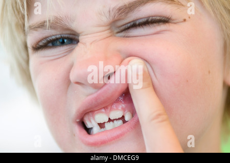 Un giovane bambino mostra i suoi denti Foto Stock